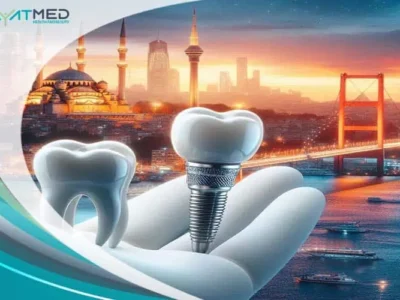 tooth implant Turkey