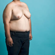 male breast reduction