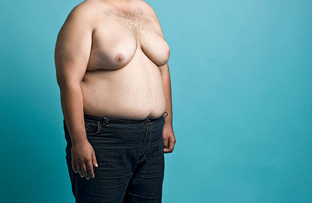 male breast reduction